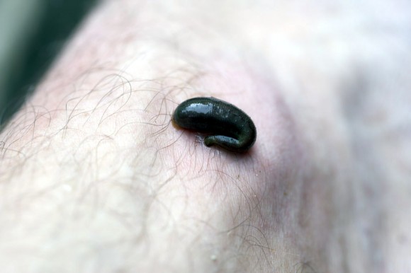 Yakushima: a leech leeching